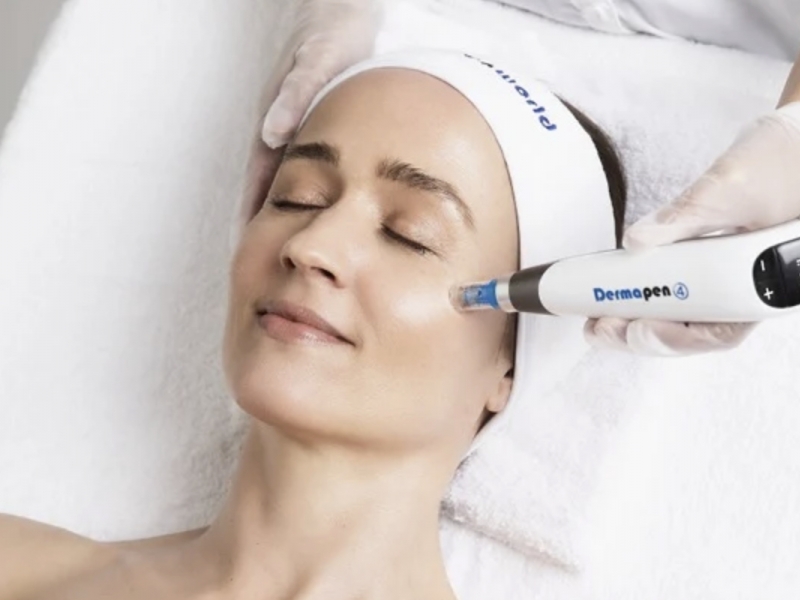 Hautregeneration mit Dermapen4™
